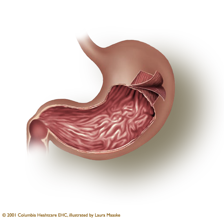Find out about the Gastric Layers