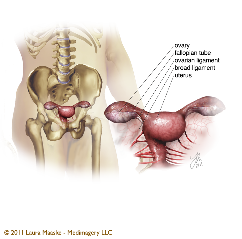 The first surgical illustration depicting the ovarian transposition proedure, or oophoropexy, where the ovary is moved out of its original place to preserve a woman's fertility.