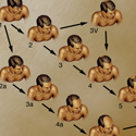 © Merck Phramaceutical
Title: Male Pattern Baldness
Author: Laura Maaske
