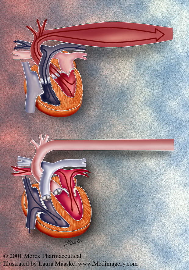 Blood_Pressure_Systole_Diastole_artery Medical Illustration. Copyrighted  © 2013 Laura Maaske - Medimagery LLC. Illustrated by Laura Maaske Medical Illustrator, Medical Animator, Biomedical Communicator, & biological artist. Do not reuse without permission. www.medimagery.com