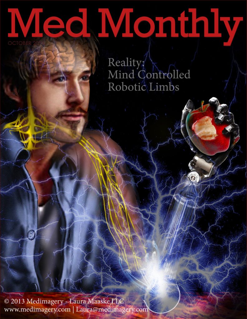 Modular Prosthetic Robotic Limb Editorial Cover Illustration for MedMonthly Magazine for Physician Audience. This medical illustration is a concept piece for a writeup about the newest techniques in robotic surgery. Design medical illustration. Illustrated by medical illustrator Laura Maaske. Copyrighted-Material www.medimagery.com © 2013 Medimagery - Laura Maaske LLC