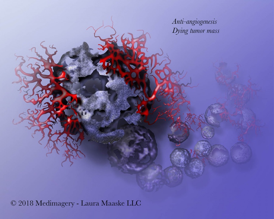 tumor cell dying Medical Illustration. Copyrighted  © 2013 Laura Maaske - Medimagery LLC. Illustrated by Laura Maaske Medical Illustrator, Medical Animator, Biomedical Communicator, & biological artist. Do not reuse without permission. www.medimagery.com