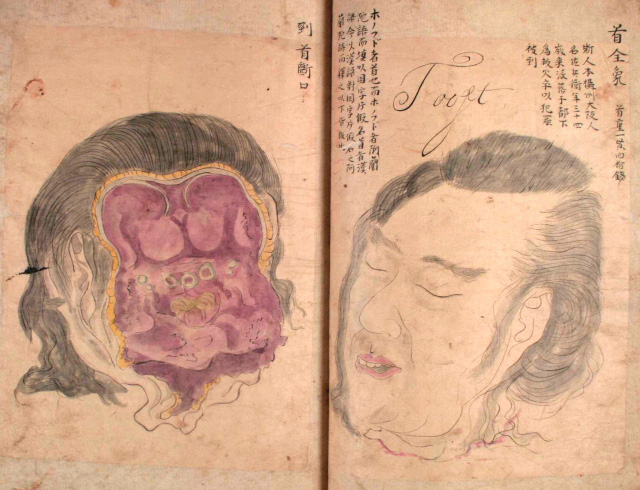 Edo-period medical illustration -- 