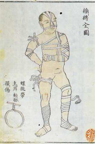 Edo-period medical illustration -- 