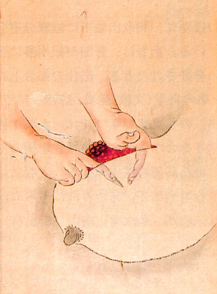 Edo-period medical illustration -- 