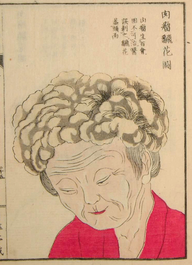 Edo-period medical illustration -- 