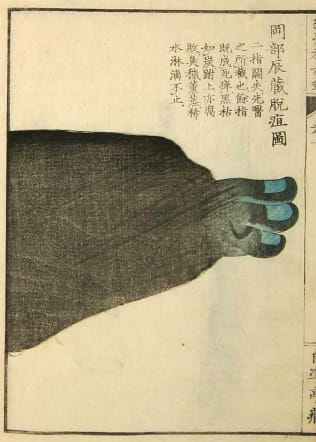 Edo-period medical illustration -- 