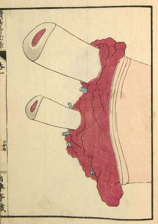 Edo-period medical illustration -- 