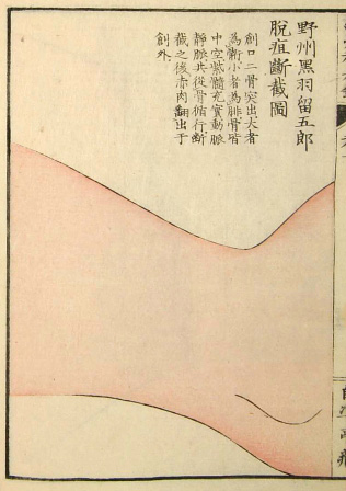 Edo-period medical illustration -- 