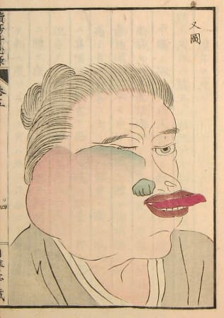 Edo-period medical illustration -- 