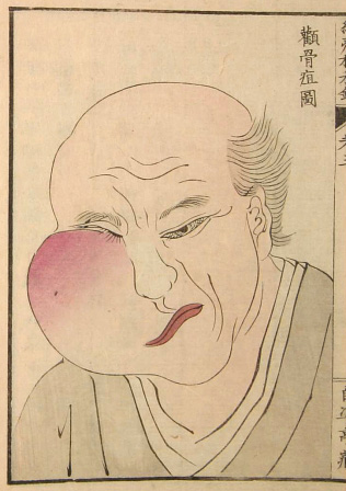 Edo-period medical illustration -- 