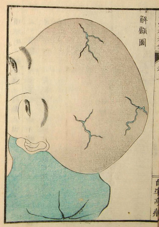 Edo-period medical illustration -- 