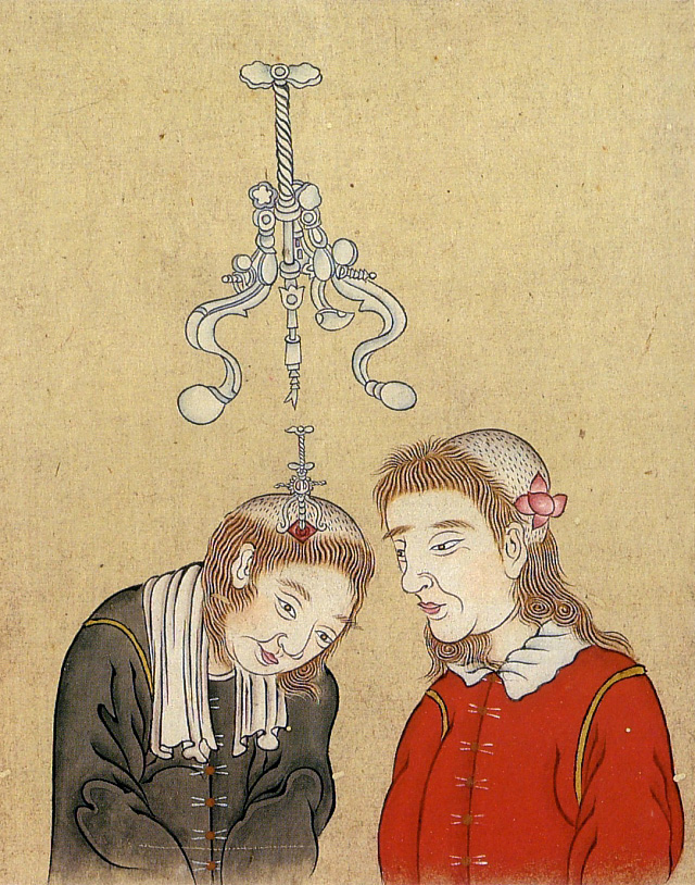 Edo-period medical illustration -- 